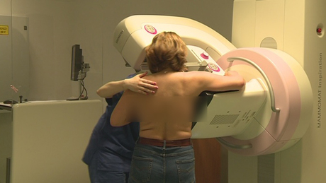 Ismét mammográfiás szűréseket tartanak Kaposváron