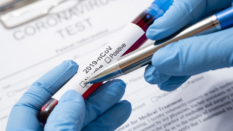 Koronavírus: 1503 új fertőzöttet regisztráltak itthon